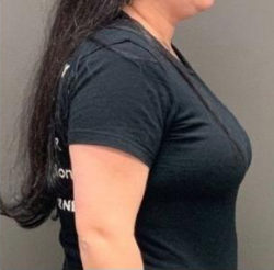 Advanced Weight Loss