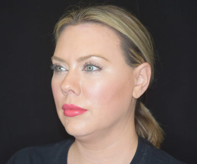Facetite