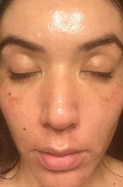 The Perfect Derma Peel